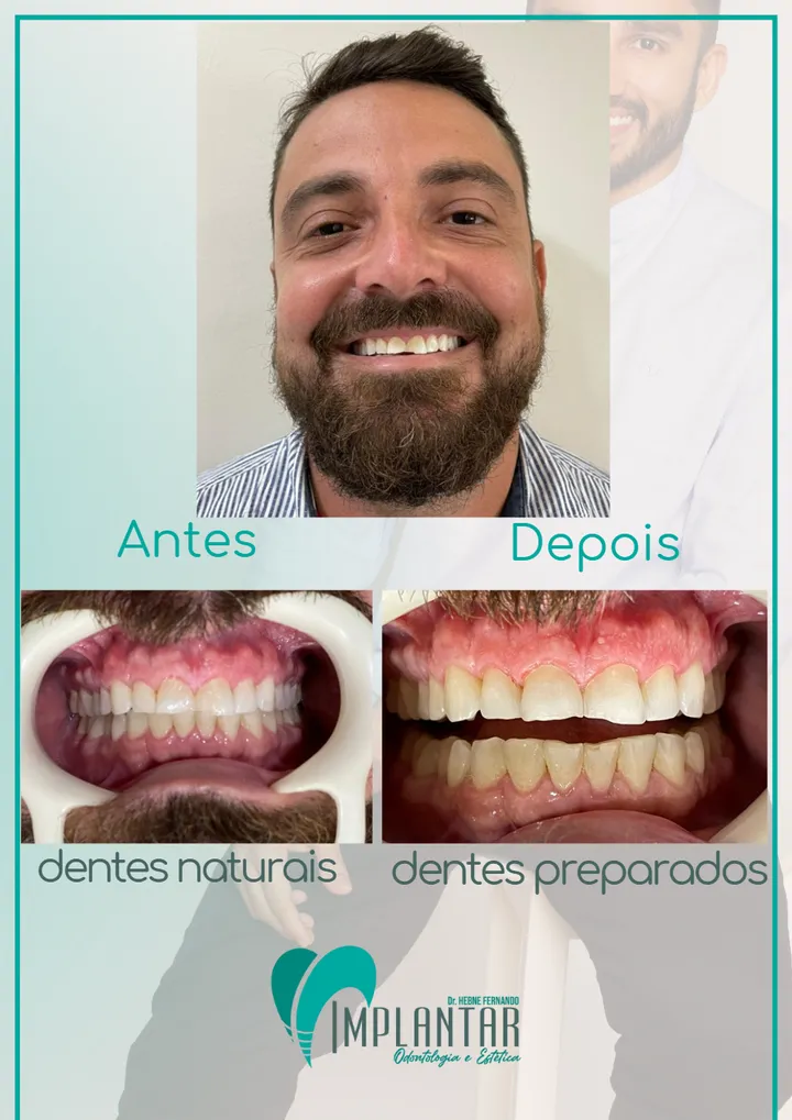 Antes e depois de tratamento dental